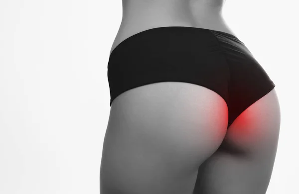 Primer plano mujer hermosas nalgas con hemorroides dolor zona roja — Foto de Stock