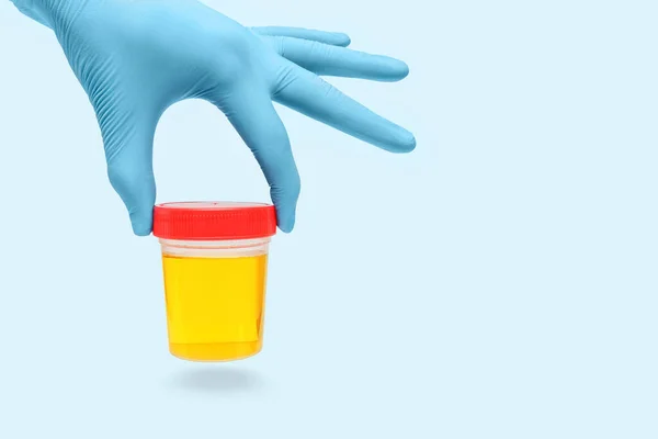 Urine Sample Analysis Jar Hands Gloves Doctor Bio Lab Worker — Stock Photo, Image
