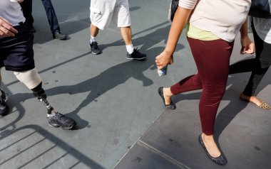 Modern bacak protezi. Taban protezi ile Engelli genç adam cadde boyunca yürür.