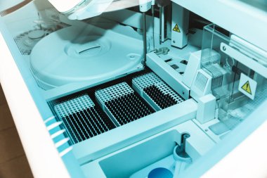 KYIV, UKRAINE - Haziran. 03, 2020: kan testi için tıbbi ekipman. Klinik laboratuvar kimyasal enfeksiyon araştırması. Coronavirus COVID-19 için laboratuvar testleri.