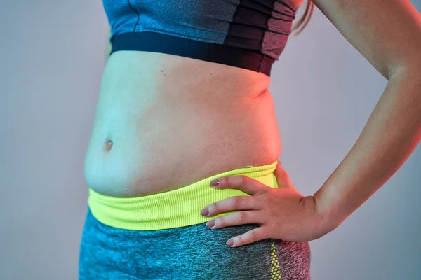 Primer Plano Del Cuerpo Una Mujer Con Sobrepeso — Foto de Stock