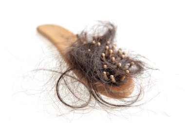 Saç dökülme problemi. 