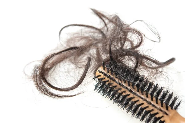 Проблема выпадения волос. — стоковое фото