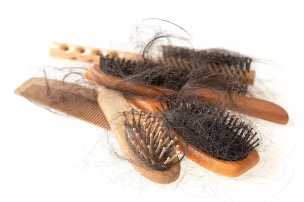 Problema caduta dei capelli . — Foto Stock