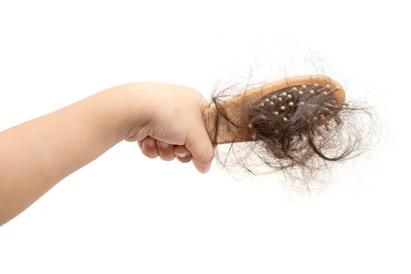 Padání vlasů u dětí. — Stock fotografie