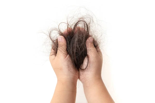 Πτώση των μαλλιών σε παιδιά. — Φωτογραφία Αρχείου
