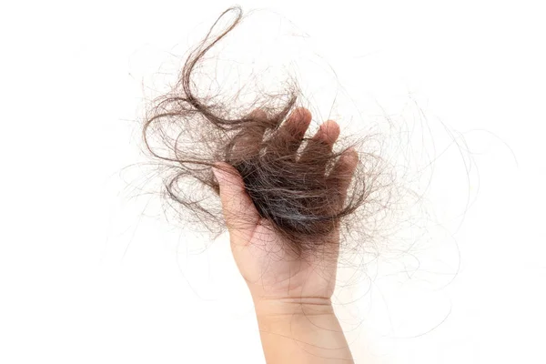 Caída de cabello en niños . —  Fotos de Stock