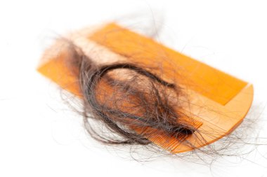 Saç dökülme problemi. 