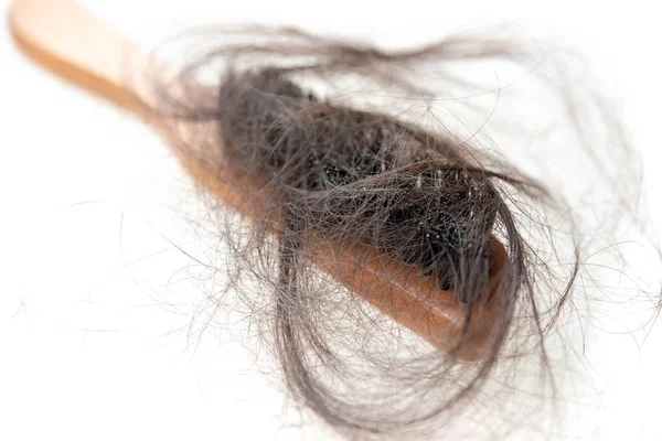 Problema di perdita dei capelli. — Foto Stock