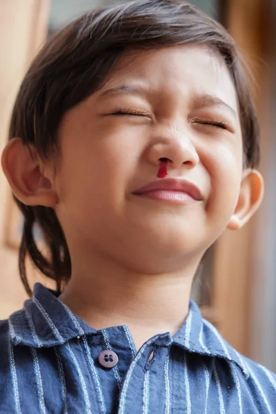 Carino asiatico bambino avendo sangue dal naso — Foto Stock