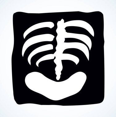 Kalça eklem bölümü hasta ağrı terapisi kontrol testi biyoloji sistemi rontgen. Siyah el çizilmiş sıhhiyeci doktor kadın omurga hasta akciğer ağrısı muayene fotoğraf logosu çizim çizelgesi