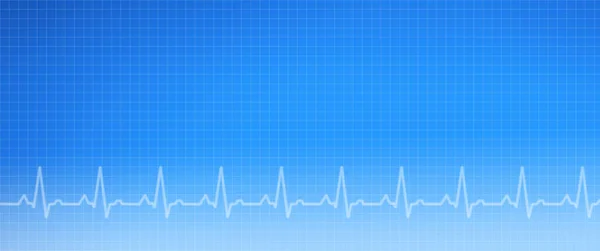 EKG Medical Graph Background — Stock Photo, Image