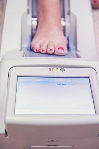 Comprobando la osteoporosis — Foto de Stock