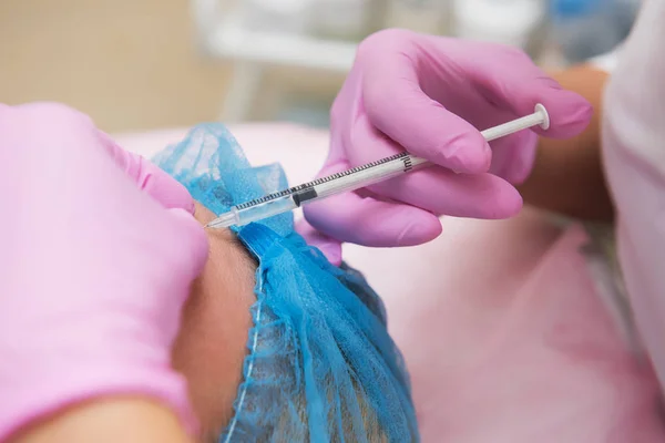 Procedure voor de behandeling van hyaluronzuur — Stockfoto