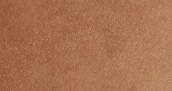 Cells on human skin — Stock Photo, Image