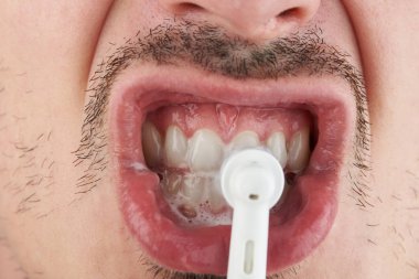 Elektrik fırça ile diş temizleme