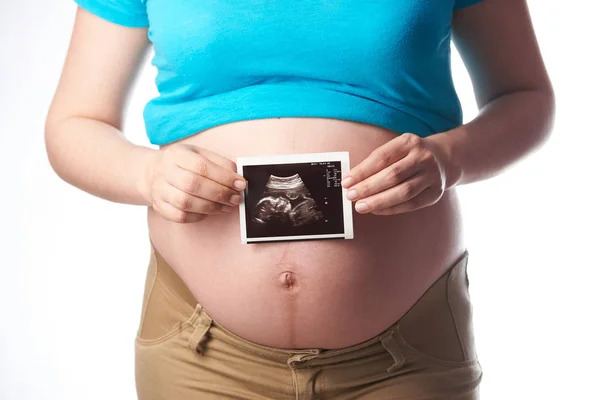 Donna incinta tenere ecografia scansione — Foto Stock