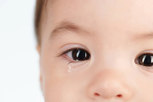Allergy on baby eye with tear — Stock Photo, Image