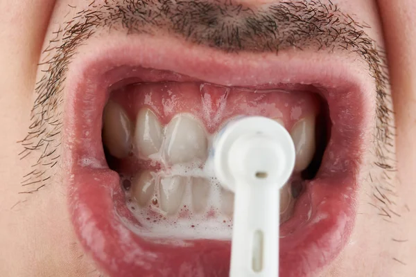 Polimento de dentes brancos — Fotografia de Stock