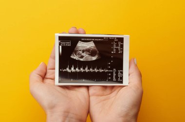 Kadın ultrason fotoğrafı çekiyor.