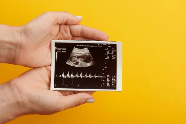 Immagine ad ultrasuoni del bambino nella pancia della donna — Foto Stock
