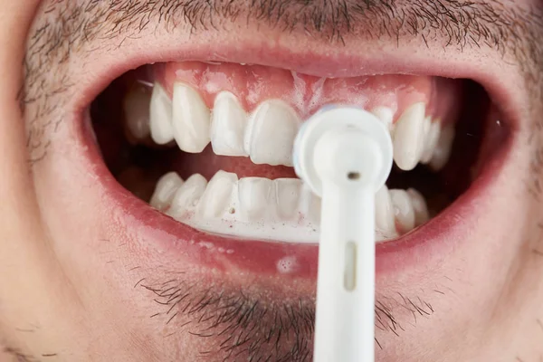 Sbiancamento dei denti tema — Foto Stock