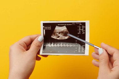 Hamile kadın bebek kontrol