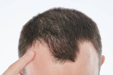 Adam, beyaz arka planda izole edilmiş olarak kafasında kalın bir noktaya işaret ediyor.