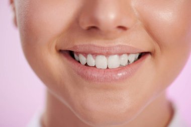 Temiz beyaz kadın dişleri, geniş gülümseme, yakın görüş.