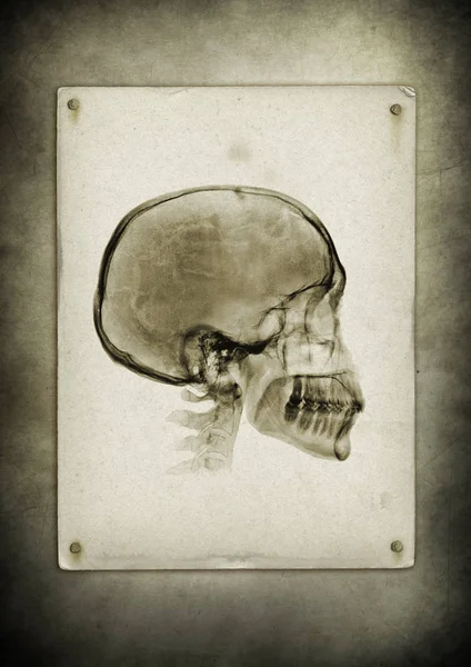 Eski bir kağıt üzerinde X-ray kafatası — Stok fotoğraf