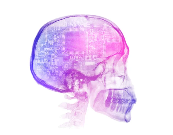 인간 두개골 X-ray 이미지. 인공지능 개념 — 스톡 사진