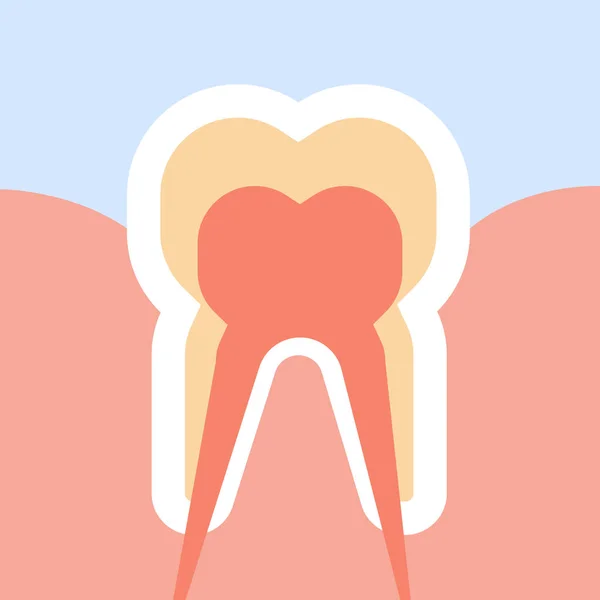 Gezonde menselijke tand in gesneden zenuwen uitgangen anatomie infographic tandheelkundige zorg concept platte structuur — Stockvector