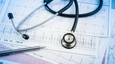 Masanın üzerinde kalp bakım için kardiyogram kavramı stetoskop.