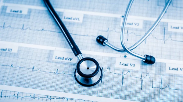 Sztetoszkóp Cardiogram Koncepció Szív Ellátás Asztalon — Stock Fotó