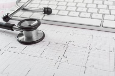 Masanın üzerinde kalp bakım için kardiyogram kavramı stetoskop.