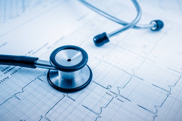 Stethoscope on cardiogram concept for heart care on the desk.blue toned images.