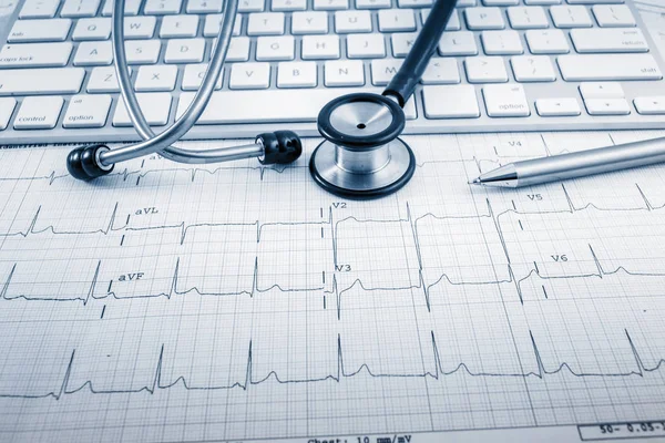 Estetoscopio Concepto Cardiograma Para Cuidado Del Corazón Escritorio Imágenes Tonificadas — Foto de Stock