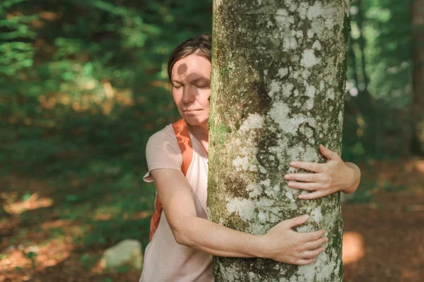 Женщина Обнимает Ствол Дерева Лесу Женщина Эколог Руками Вокруг Дерева — стоковое фото