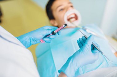 Mühür yükleme işlemi, Pediatrik Diş Hekimliği, çocuklar stomatology. Kadın dişçi bir çocuk diş kliniği ile çalışır