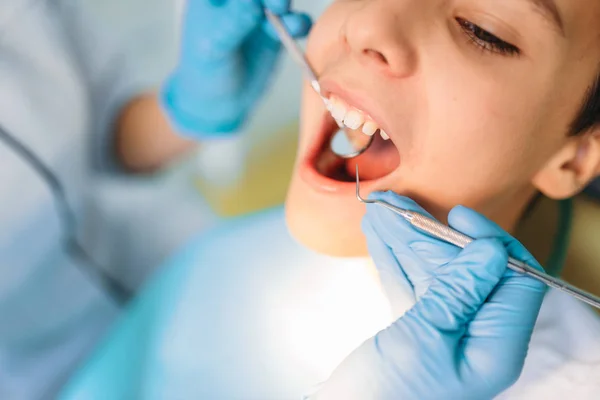 Little Boy Open Mouth Dental Cabinet Pediatric Dentistry Female Dentist — Stock Photo, Image