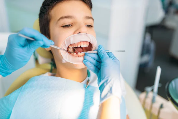 小男孩张开嘴在牙科柜 蛀牙去除程序 儿科牙科 女牙医寻找蛀牙 — 图库照片