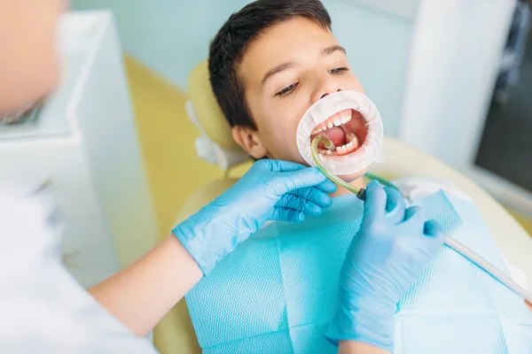 Niño Con Boca Abierta Gabinete Dental Procedimiento Eliminación Caries Odontología — Foto de Stock