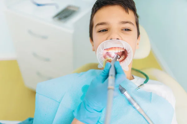 蛀牙切除程序 儿科牙科 女牙医钻牙 牙科诊所 — 图库照片