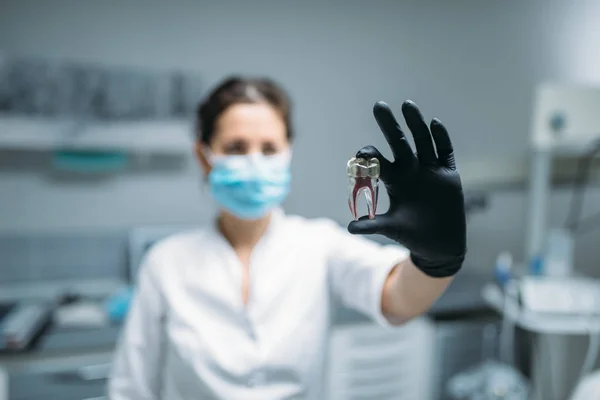 Γυναίκα Οδοντίατρος Δείχνει Δόντι Μοντέλο Οδοντιατρική Κλινική Επαγγελματική Προσθετική Οδοντιατρική — Φωτογραφία Αρχείου