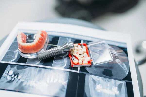 Takma Dişler Diş Hekimliği Kliniği Closeup Dişçi Ekipmanları Stomatology Kabin — Stok fotoğraf