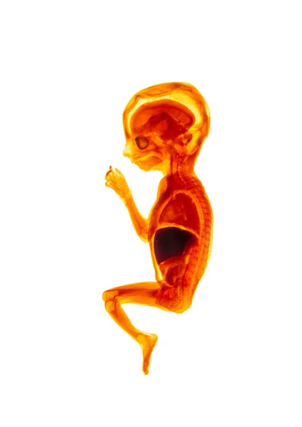 Reproductie Van Het Menselijk Embryo Embryo Genesis Informatie Poster Embryonale — Stockfoto