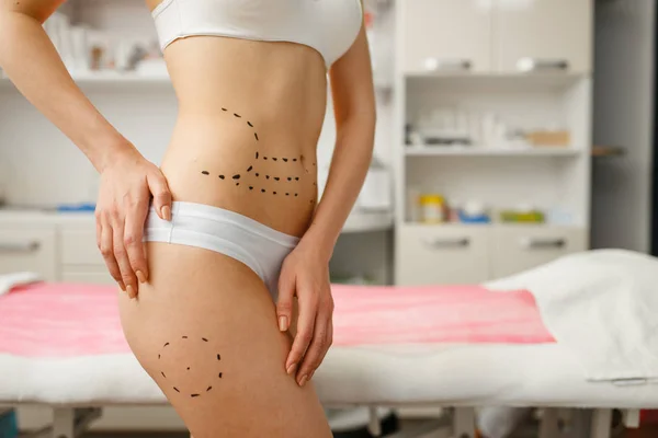 Female Patient Markers Her Body Cosmetician Office Rejuvenation Procedure Beautician — Stock Photo, Image