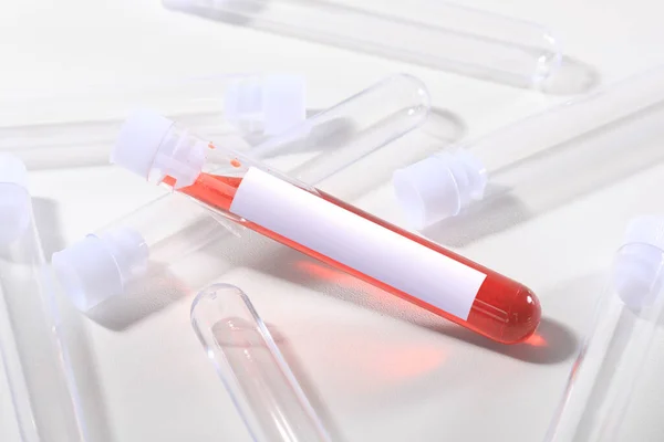 Salgın Stili Kan Test Tüpleri Üzerinde Etiketle — Stok fotoğraf