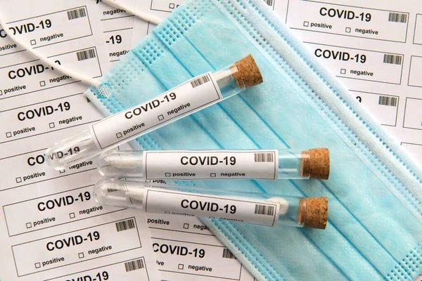 Many Covid Test Tubes Lots Testing — Stock Photo, Image