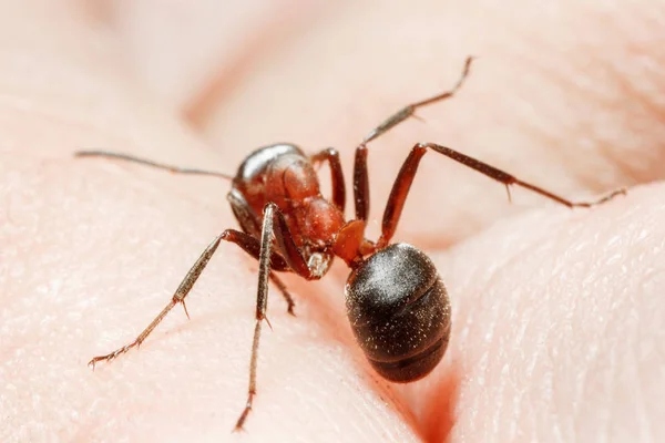 Cilt Üzerinde Karınca Isırıkları Bir Karınca Insan Derisi Üzerinde — Stok fotoğraf